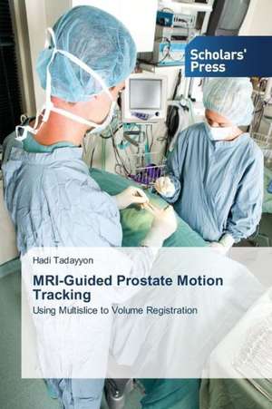 MRI-Guided Prostate Motion Tracking de Hadi Tadayyon