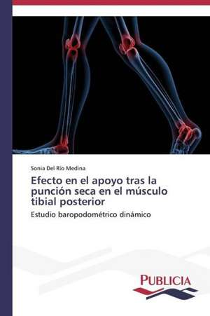 Efecto En El Apoyo Tras La Puncion Seca En El Musculo Tibial Posterior: Variacion Debida Al Ambiente y Genotipo de Sonia Del Río Medina