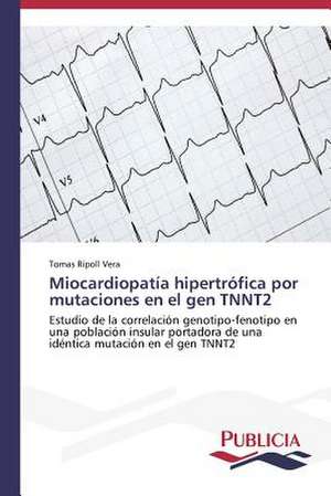 Miocardiopatia Hipertrofica Por Mutaciones En El Gen Tnnt2: Un Ilustrado En Tiempos de Oscuridad de Tomas Ripoll Vera