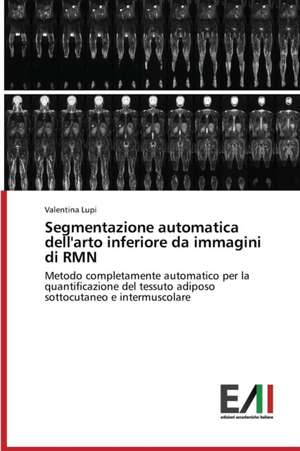 Segmentazione Automatica Dell'arto Inferiore Da Immagini Di Rmn: Ruolo Sull'assorbimento Percutaneo de Valentina Lupi