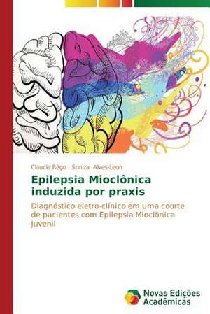 Epilepsia Mioclonica Induzida Por Praxis