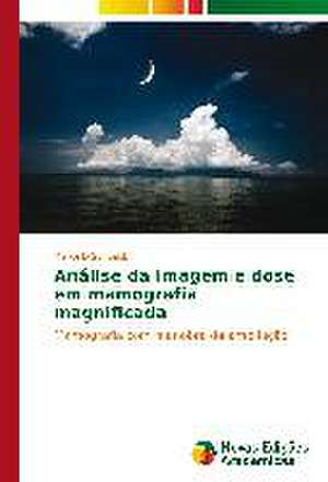 Analise Da Imagem E Dose Em Mamografia Magnificada: Centralizacao, Descentralizacao E Desconcentracao de Marcello Schuabb