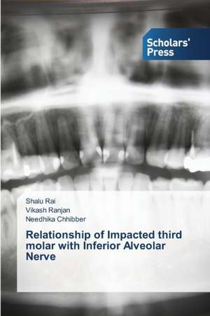 Relationship of Impacted Third Molar with Inferior Alveolar Nerve