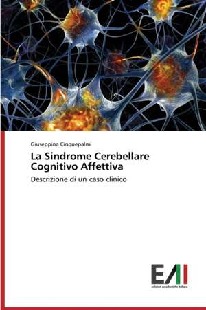 La Sindrome Cerebellare Cognitivo Affettiva de Giuseppina Cinquepalmi