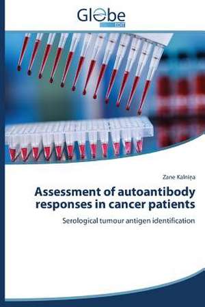 Assessment of Autoantibody Responses in Cancer Patients: Censura Ou Democracia? de Zane Kalnina