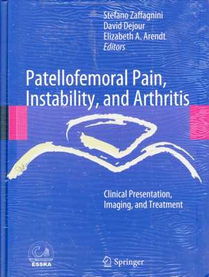 Patellofemoral Pain, Instability, and Arthritis: Clinical Presentation, Imaging, and Treatment de Stefano Zaffagnini