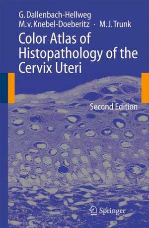 Color Atlas of Histopathology of the Cervix Uteri de Gisela Dallenbach-Hellweg