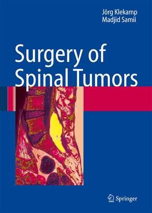 Surgery of Spinal Tumors de Jörg Klekamp