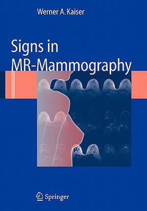 Signs in MR-Mammography de Werner A. Kaiser