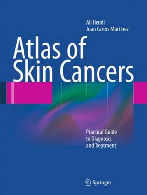 Atlas of Skin Cancers: Practical Guide to Diagnosis and Treatment de Ali Hendi