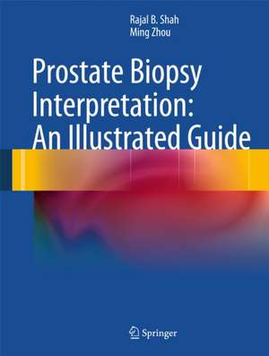 Prostate Biopsy Interpretation: An Illustrated Guide de Rajal B. Shah