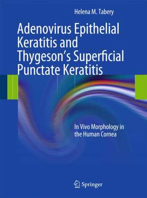 Adenovirus Epithelial Keratitis and Thygeson's Superficial Punctate Keratitis: In Vivo Morphology in the Human Cornea de Helena M. Tabery