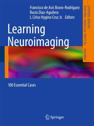 Learning Neuroimaging: 100 Essential Cases de Francisco de Asís Bravo-Rodríguez