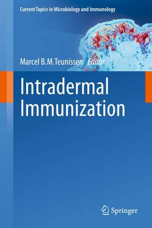 Intradermal Immunization de Marcel B. M. Teunissen