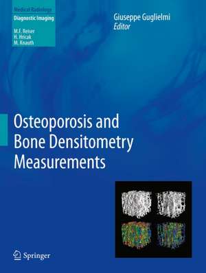 Osteoporosis and Bone Densitometry Measurements de Giuseppe Guglielmi