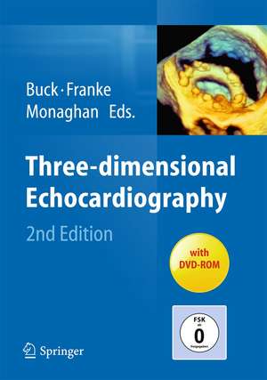 Three-dimensional Echocardiography de Thomas Buck