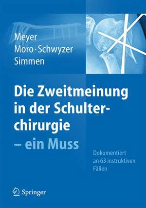 Die Zweitmeinung in der Schulterchirurgie - ein Muss de Rainer Peter Meyer