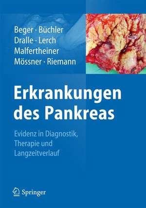 Erkrankungen des Pankreas: Evidenz in Diagnostik, Therapie und Langzeitverlauf de Hans G. Beger