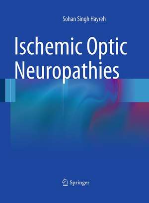 Ischemic Optic Neuropathies de Sohan Singh Hayreh