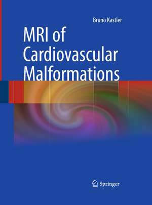 MRI of Cardiovascular Malformations de Bruno Kastler