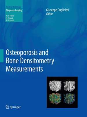 Osteoporosis and Bone Densitometry Measurements de Giuseppe Guglielmi