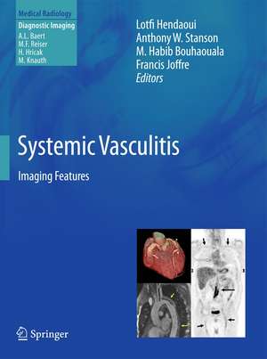 Systemic Vasculitis: Imaging Features de Lotfi Hendaoui