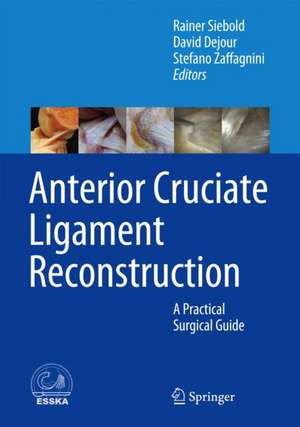 Anterior Cruciate Ligament Reconstruction: A Practical Surgical Guide de Rainer Siebold