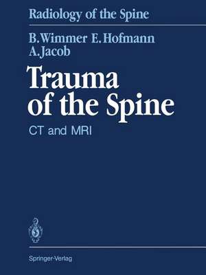 Trauma of the Spine: CT and MRI de Berthold Wimmer