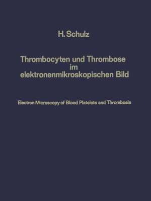 Thrombocyten und Thrombose im elektronenmikroskopischen Bild / Electron Microscopy of Blood Platelets and Thrombosis de Heribert Schulz