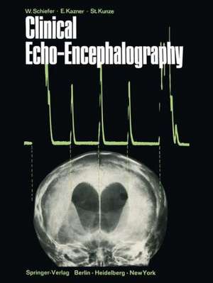 Clinical Echo-Encephalography de Wolfgang Schiefer