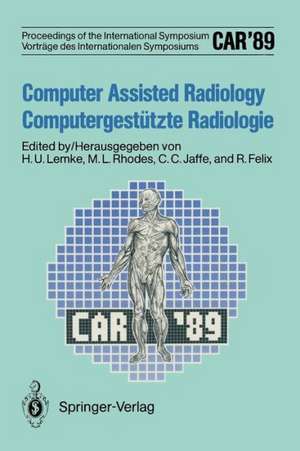 CAR’89 Computer Assisted Radiology / Computergestützte Radiologie: Proceedings of the 3rd International Symposium / Vorträge des 3. Internationalen Symposiums de Heinz U. Lemke