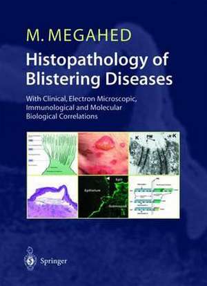 Histopathology of Blistering Diseases: With Clinical, Electron Microscopic, Immunological and Molecular Biological Correlations Textbook and Atlas de Mosaad Megahed