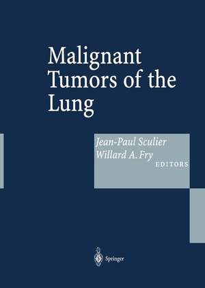 Malignant Tumors of the Lung: Evidence-based Management de Jean-Paul Sculier