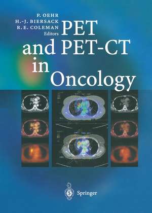 PET and PET-CT in Oncology de Peter Oehr