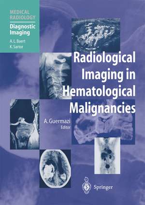 Radiological Imaging in Hematological Malignancies de Ali Guermazi