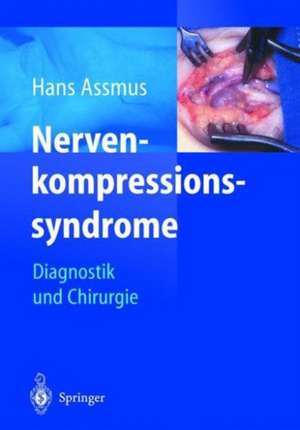 Nerven-kompressions-syndrome: Diagnostik und Chirurgie de G. Antoniadis