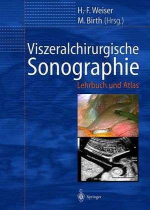 Viszeralchirurgische Sonographie: Lehrbuch und Atlas de H.F. Weiser