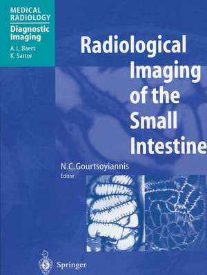 Radiological Imaging of the Small Intestine de N.C. Gourtsoyiannis