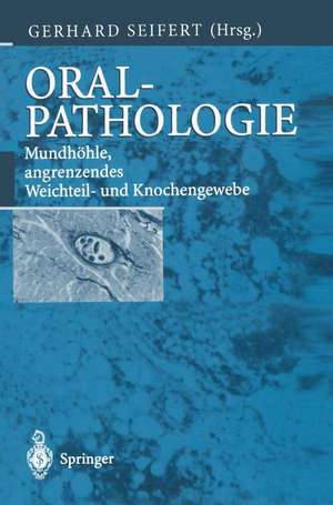 Oralpathologie: Mundhöhle, angrenzendes Weichteil- und Knochengewebe de Gerhard Seifert