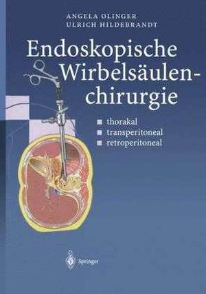 Endoskopische Wirbelsäulenchirurgie: thorakal · transperitoneal · retroperitoneal de Angela Olinger