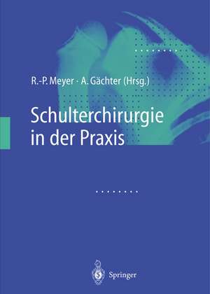 Schulterchirurgie in der Praxis de R. -P Meyer