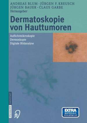 Dermatoskopie von Hauttumoren: Auflichtmikroskopie — Dermoskopie — Digitale Bildanalyse de A. Blum