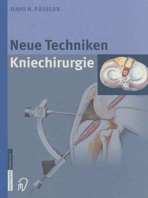 Neue Techniken Kniechirurgie de H.H. Pässler