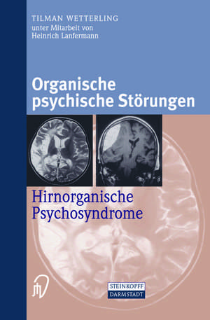 Organische psychische Störungen: Hirnorganische Psychosyndrome de H. Lanfermann