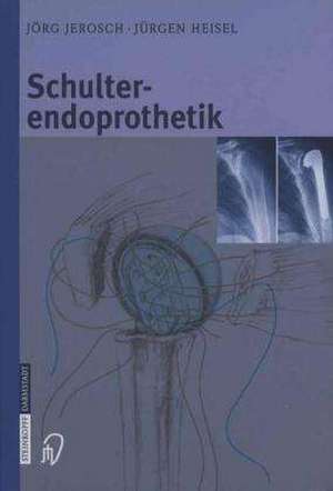 Schulterendoprothetik: Indikation, Implantate, OP-Technik, Nachbehandlung, Begutachtung de W. Attmanspacher