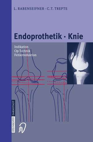 Endoprothetik Knie de L. Rabenseifner