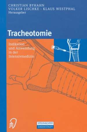 Tracheotomie: Indikation und Anwendung in der intensivmedizin de C. Byhahn