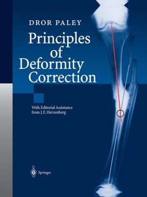 Principles of Deformity Correction de J.E. Herzenberg