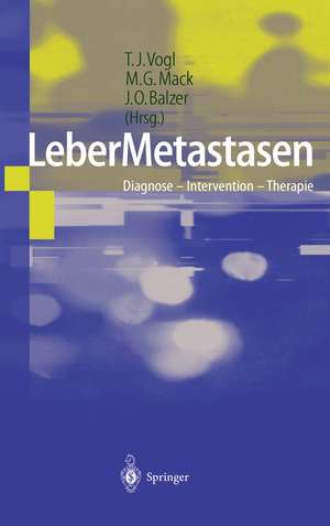 LeberMetastasen: Diagnose — Intervention — Therapie de T.J. Vogl