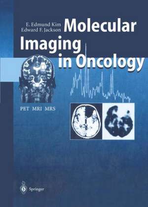 Molecular Imaging in Oncology: PET, MRI, and MRS de E. Edmund Kim